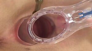 Closeup speculum and dildo play
